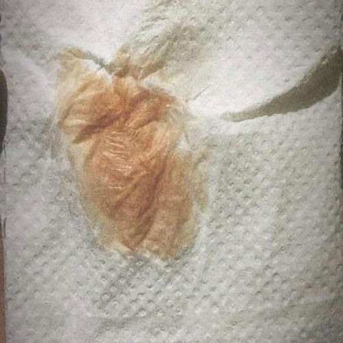 SPOTTING ON 10WEEKS AND 5DAYS