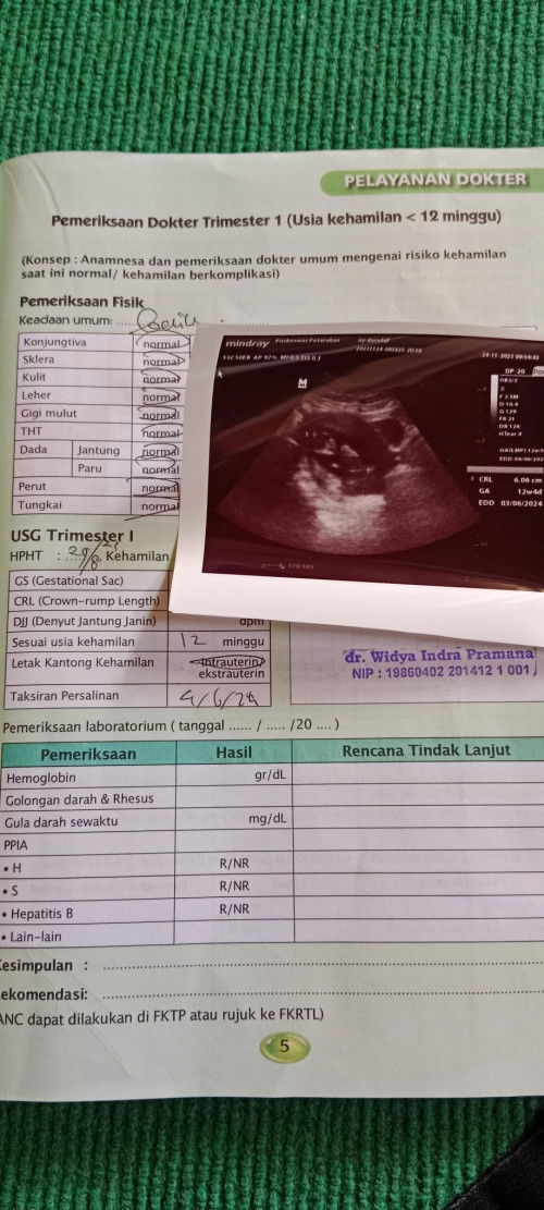 Bagaimana cara membaca hasil USG?