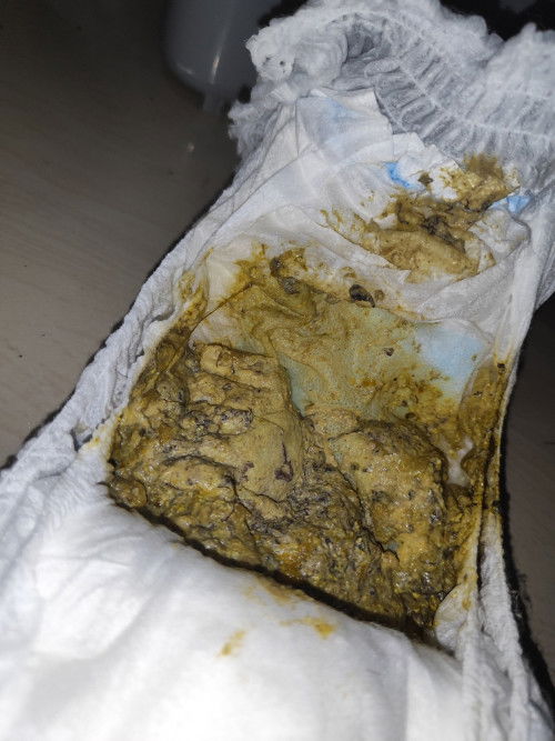 Poop ni baby after kumain Ng saging