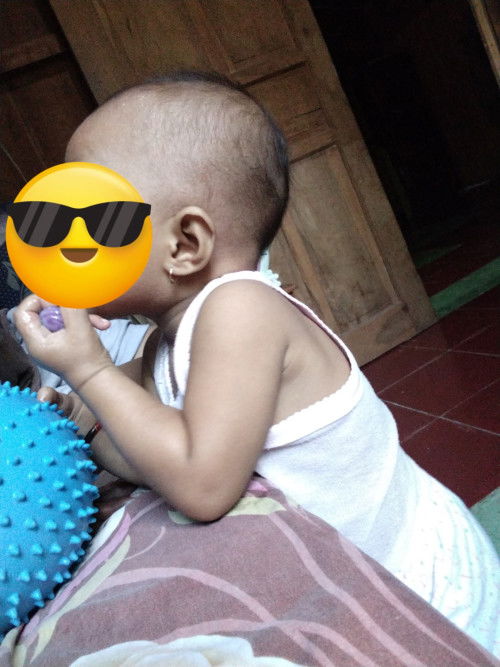 Bun anakku udh 14bulan tp kok msih tipis bgt ya rambutnya, minta saran gmna solusinya ?