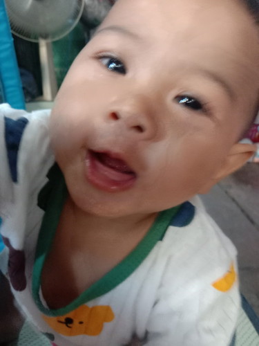 10เดือนฟันยังไม่ขึ้น