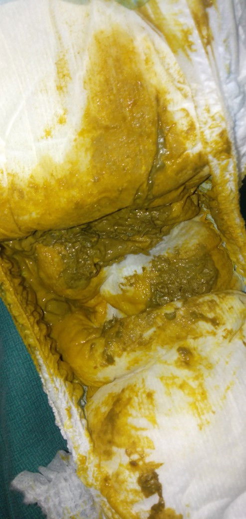 น้องอึแบบนี้