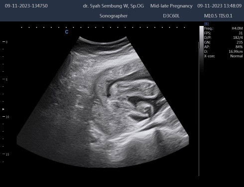 Menurut bunda cwe atau cwo