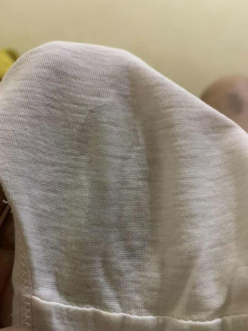 Apakah keputihan atau ketuban rembes sedikit sedikit ya?