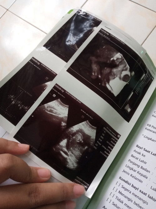 Cara memicu kontraksi