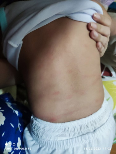 Ano po kaya Yan pula pula ngayon ko lang nkita sa likod nya Wala nman Yan kanina umaga