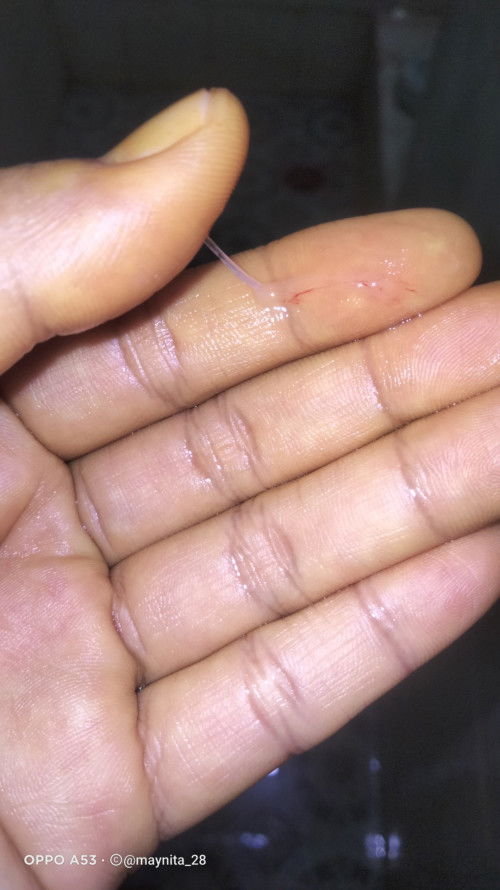 Flek kehamilan atau haid ?