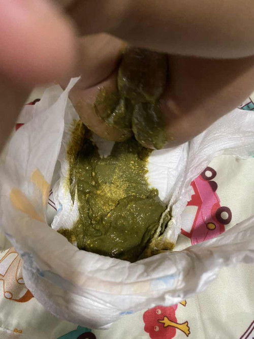 Najis Bertukar Warna Hijau