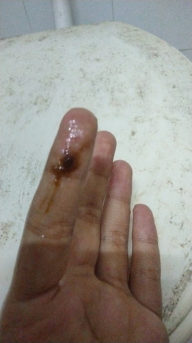Perlu ke hospital ke 38 week