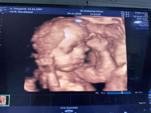 26สัปดาห์ ลูกในท้องน้ำหนักเท่าไรกันบ้างค่ะ