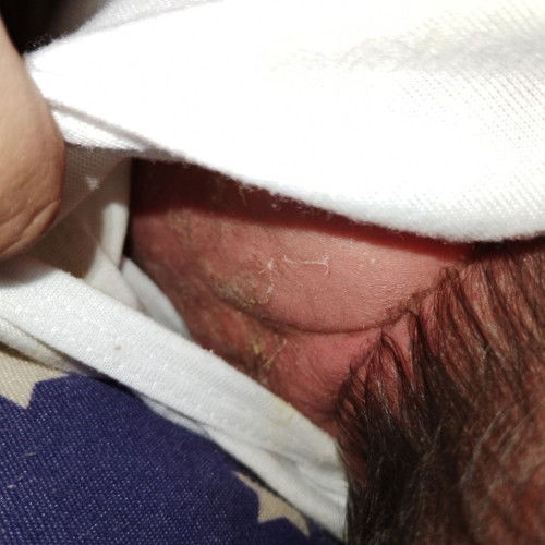 Hello po first time mom here, namamalat po si baby kulay yellow:((