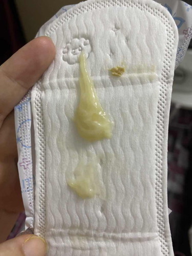 mucus plug atau bukan? 39w 3d
