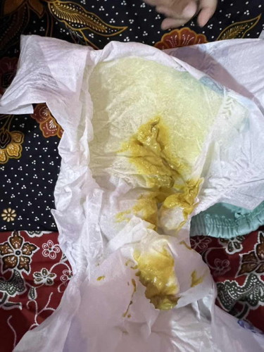 Normalkan najis bayi?