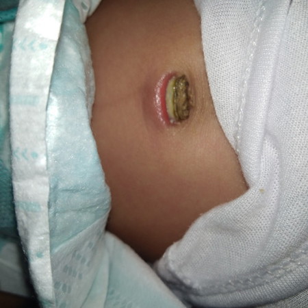 mga mie ilang weeks po baa pinaka matagal bago mabahaw ang pusod ng baby yung sa baby ko po kasi