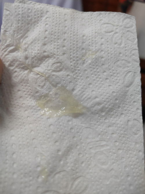 อายุครรภ์ 33 week มีมูกแบบนี้ออกมาจากช่องคลอด ไม่เยอะประมาณตามภาพ คือสัญญาณอะไรคะ  #ท้องแรก