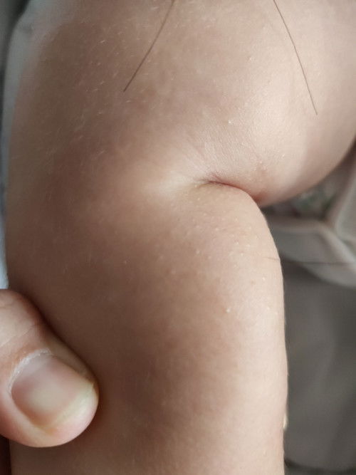 What are these bumps?