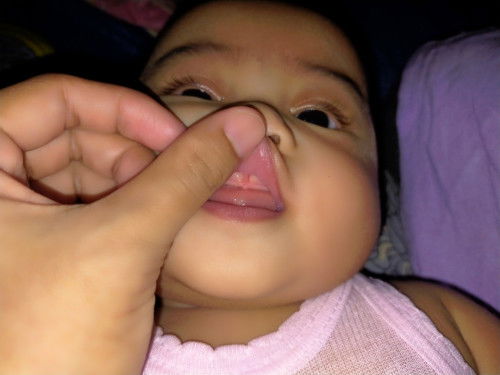 Apakah ini lip tongue?