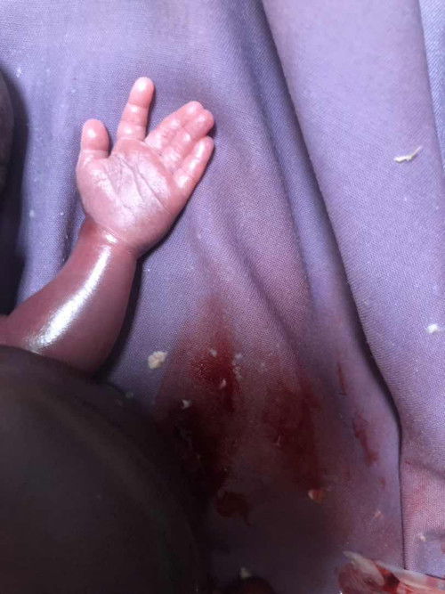 ลูกตายตอน22วีค ไม่คิดว่าจะเกิด
กับตัวเอง ใจสลายเหลือเกิน ลูกชายคนแรกแท้ๆ