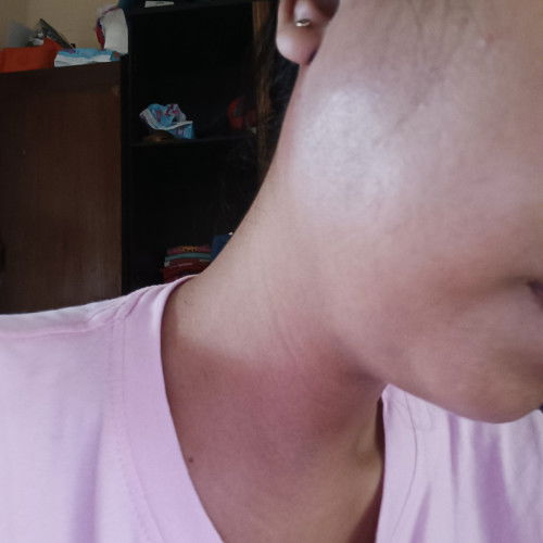 Gimana cara supaya gondongan bisa kempes? Rasanya nyut"an bgt ini yg saya rasain