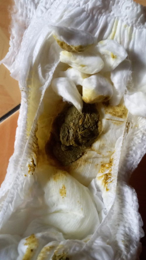 Pup hijau
Maaf, kalau jorok. Tapi saya butuh sharing