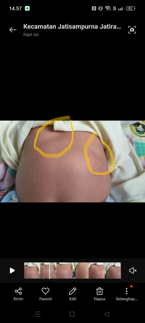 Cekungan di atas perut