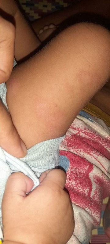 Adakah yg tau obatnya