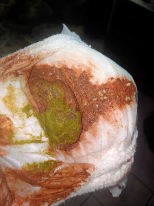 PUP ANAK BERWARNA KEMERAHAN