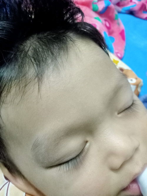 แพ้ไข่ขาว เด็ก8เดือน