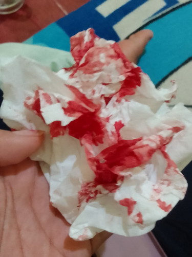 Yang pernah ngalami mohon tanggapannya ππ