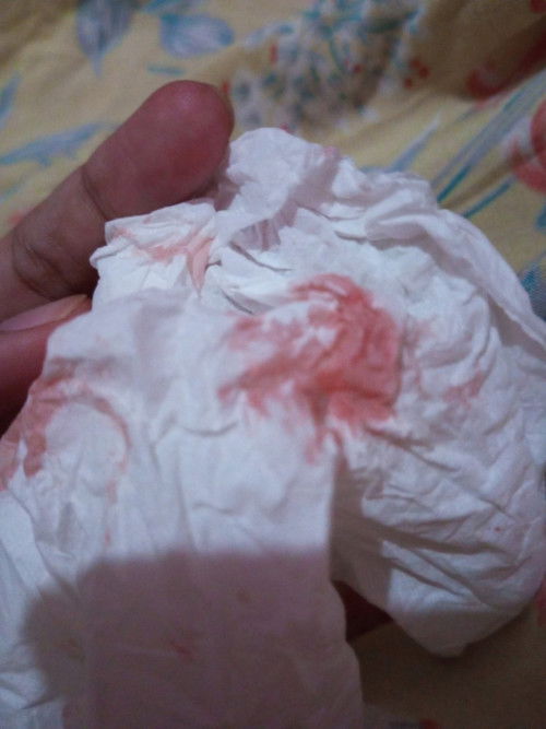 Hamil lagi anak baru usia 6bulan tapi kmrn sore kluar darah kira2 kenapa ya ?? Blm di USG soalnya