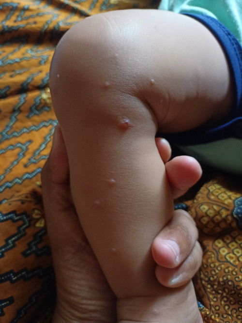 Bayi kulitnya bintik2 kenapa ya?