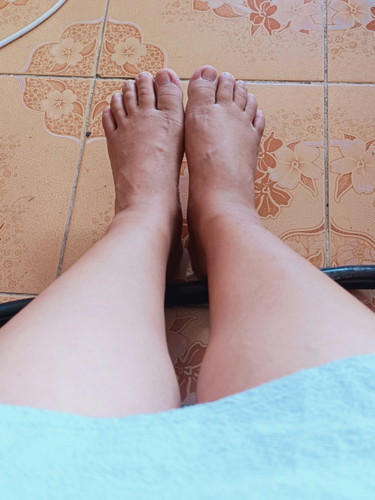 คุณแม่เริ่มเท้าบวมกันกี่ Week ค่ะทางนี้ 27 Week กำลังบวม
#ท้องแรกทีมกุมพาพันธ์