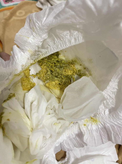 นมแม่+นมผสม สีอึลูก