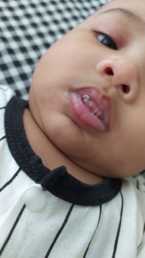 Adalah tanda alahan?