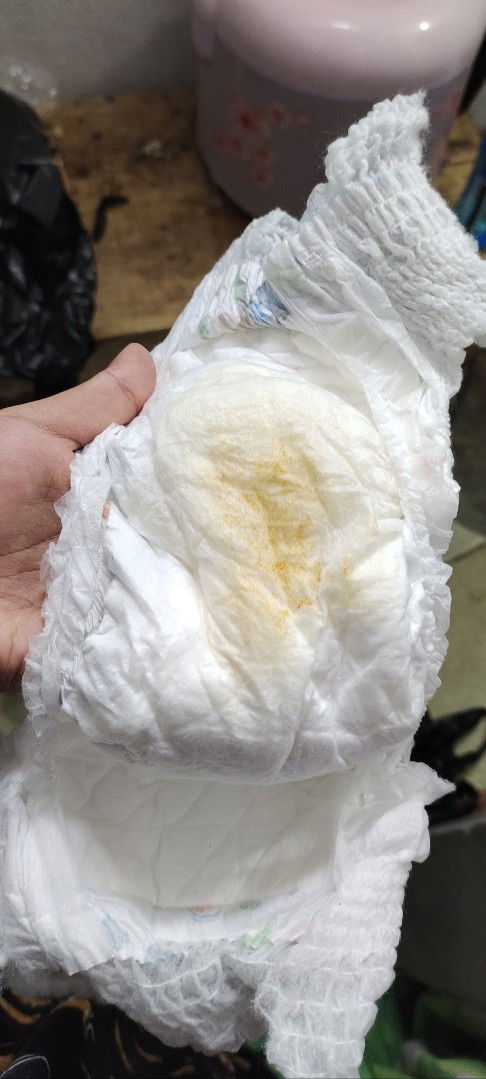 Bercak Orange Pada Diapers