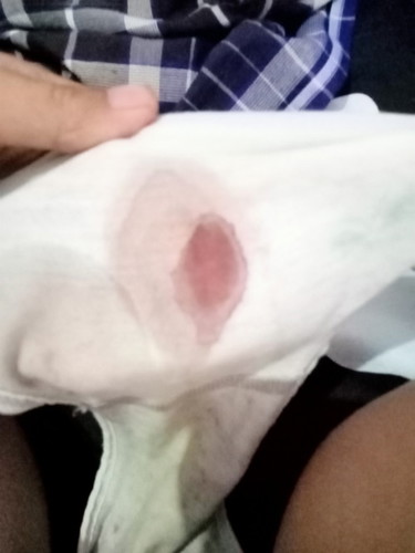 bun mau tanya kalau pendarahan kaya gini harus ke RS langsung bisa ?