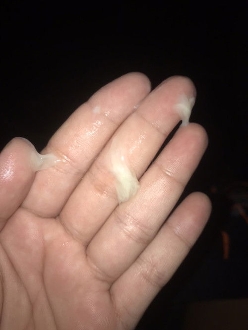 ท้อง38+5ท้องแรก