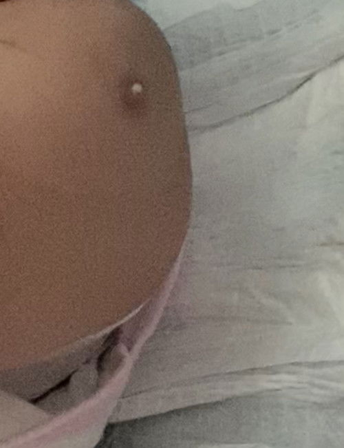 Pigsa sa pwet (2months old)