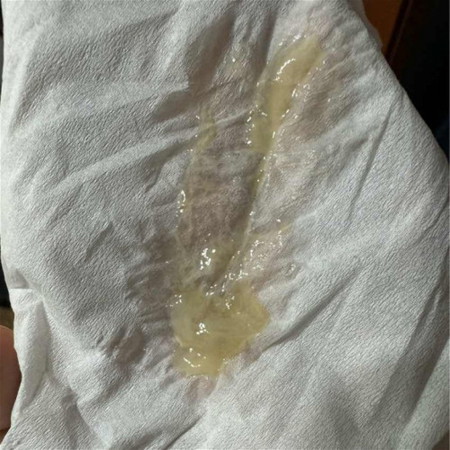MUCUS PLUG KE?