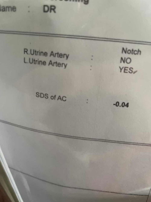 L uterine artery notch