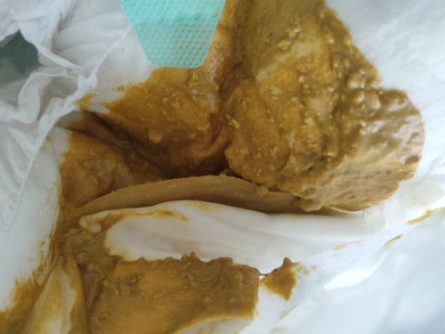 สอบถามน่อยคะ ลูกไม่ขี้มา4วันพึงมาขี้วันนี้