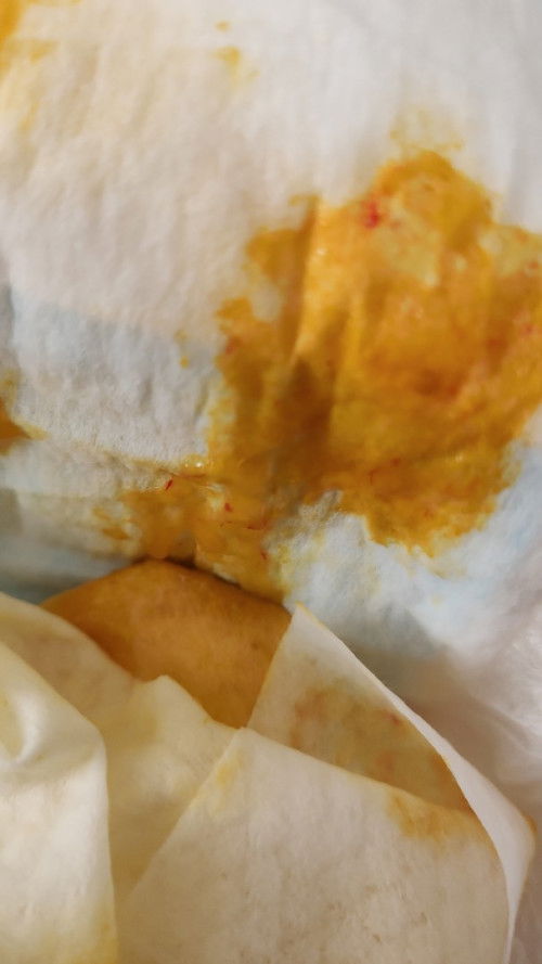 Najis bayi 2 bulan dan dah ambil imunisasi