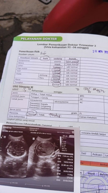 Perbedaan usia kehamilan menurut bidan dan USG