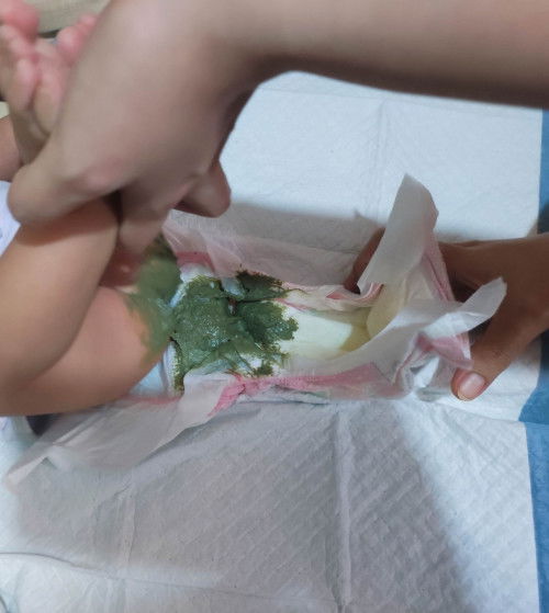 Hello mga momsh! just wanted to ask if I'm the only mom here whose baby has this poop color