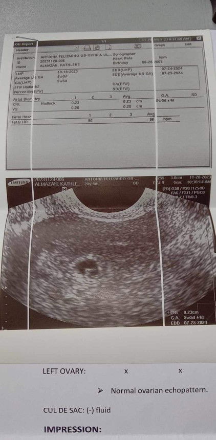 Threatened miscarriage. What to do? Transvaginal ultrasound may bleeding pero may heart beat si baby