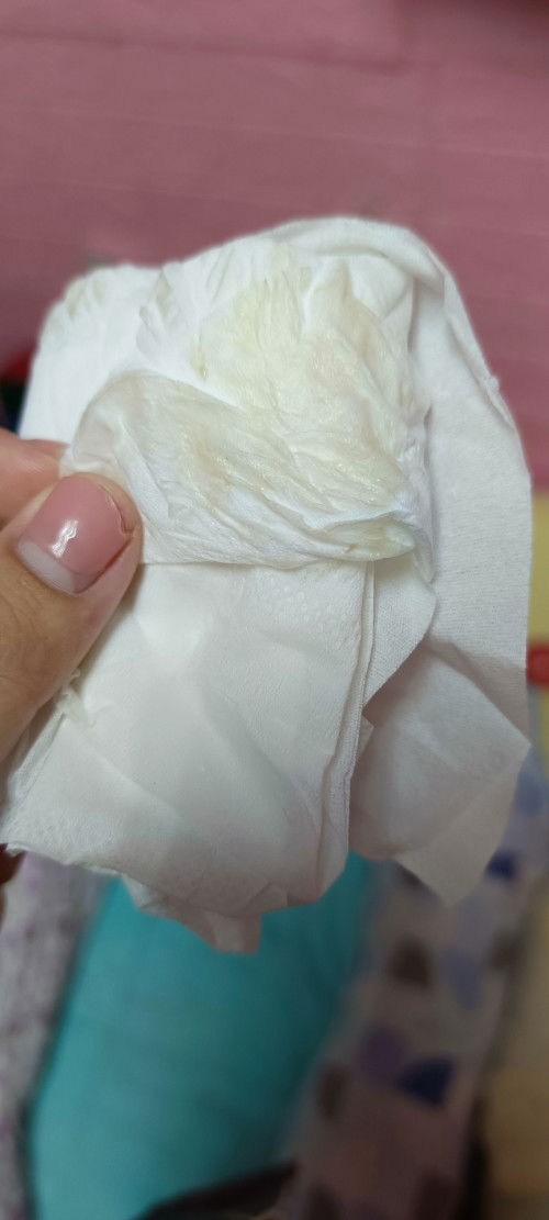 โดนกระตุ้นปากมดลูกแล้วมีเหมือนเลือดสีนํ้าตาลๆออกแบบปกติมั้ยค่ะเเม่ๆ