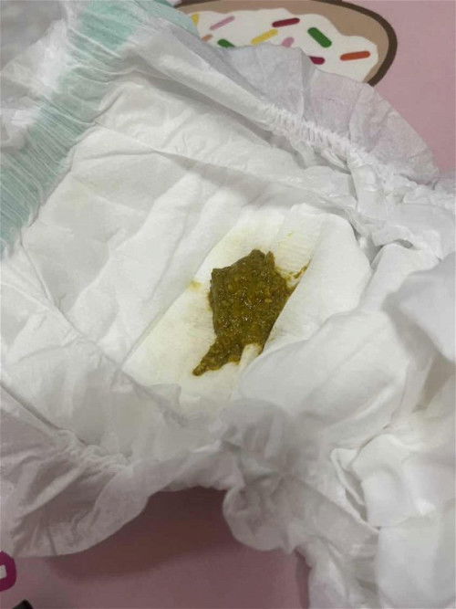 แบบนี้ถ่ายปกติไหมค่ะ