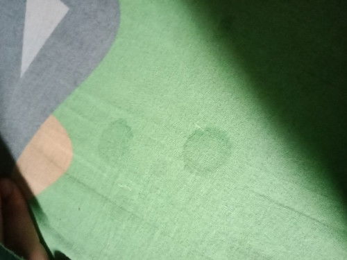 มีน้ำซึมออกมา