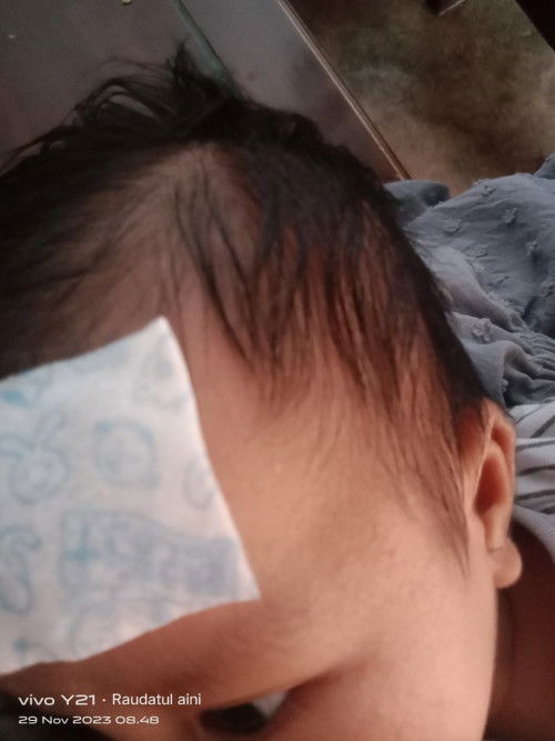 Bayi 1bulan badan panas anget²