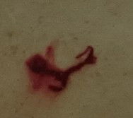 Apakah ini tanda keguguran?